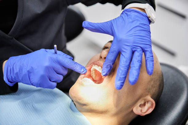 Best Emergency Dental Extractions in Demopolis, AL